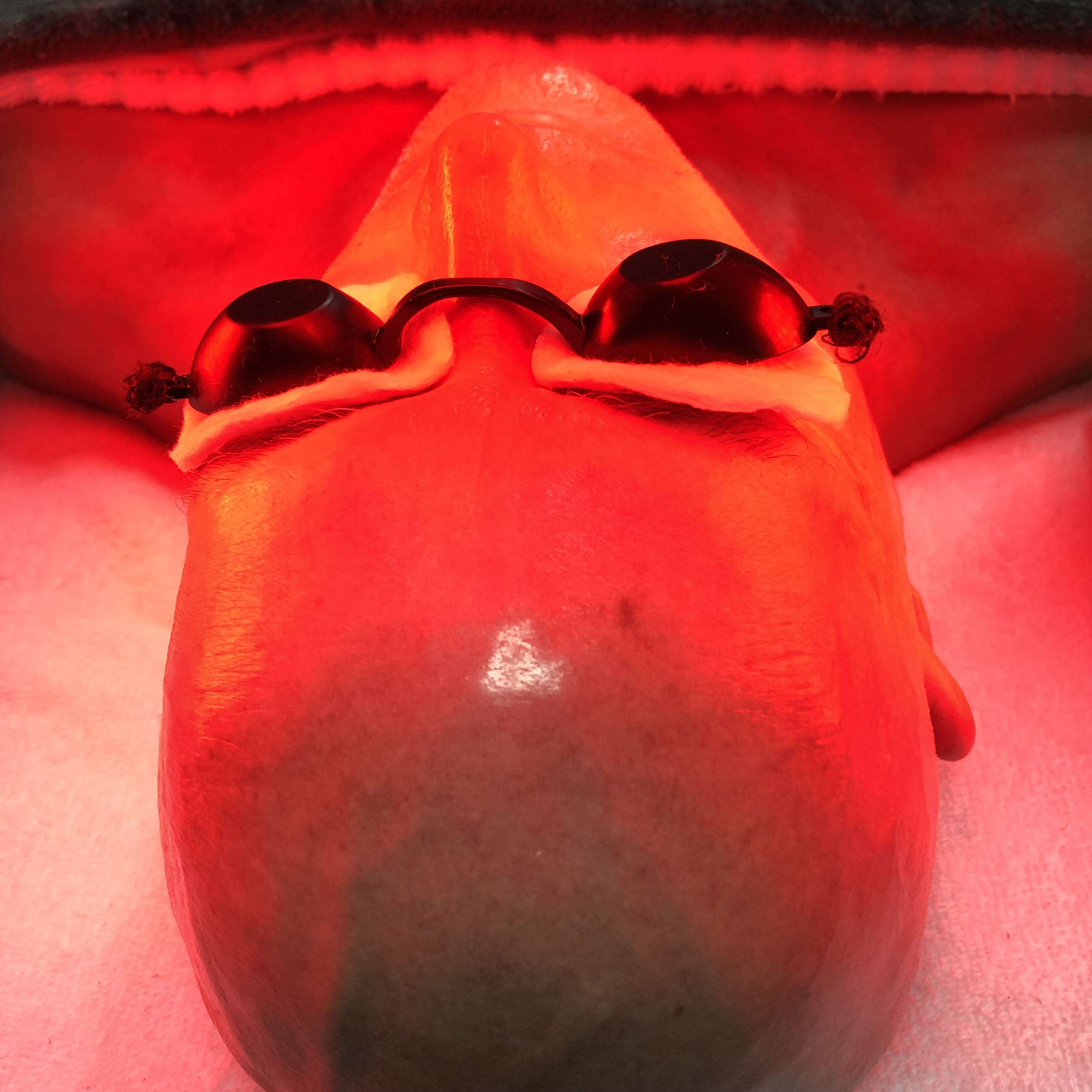 Red Light Facial.png